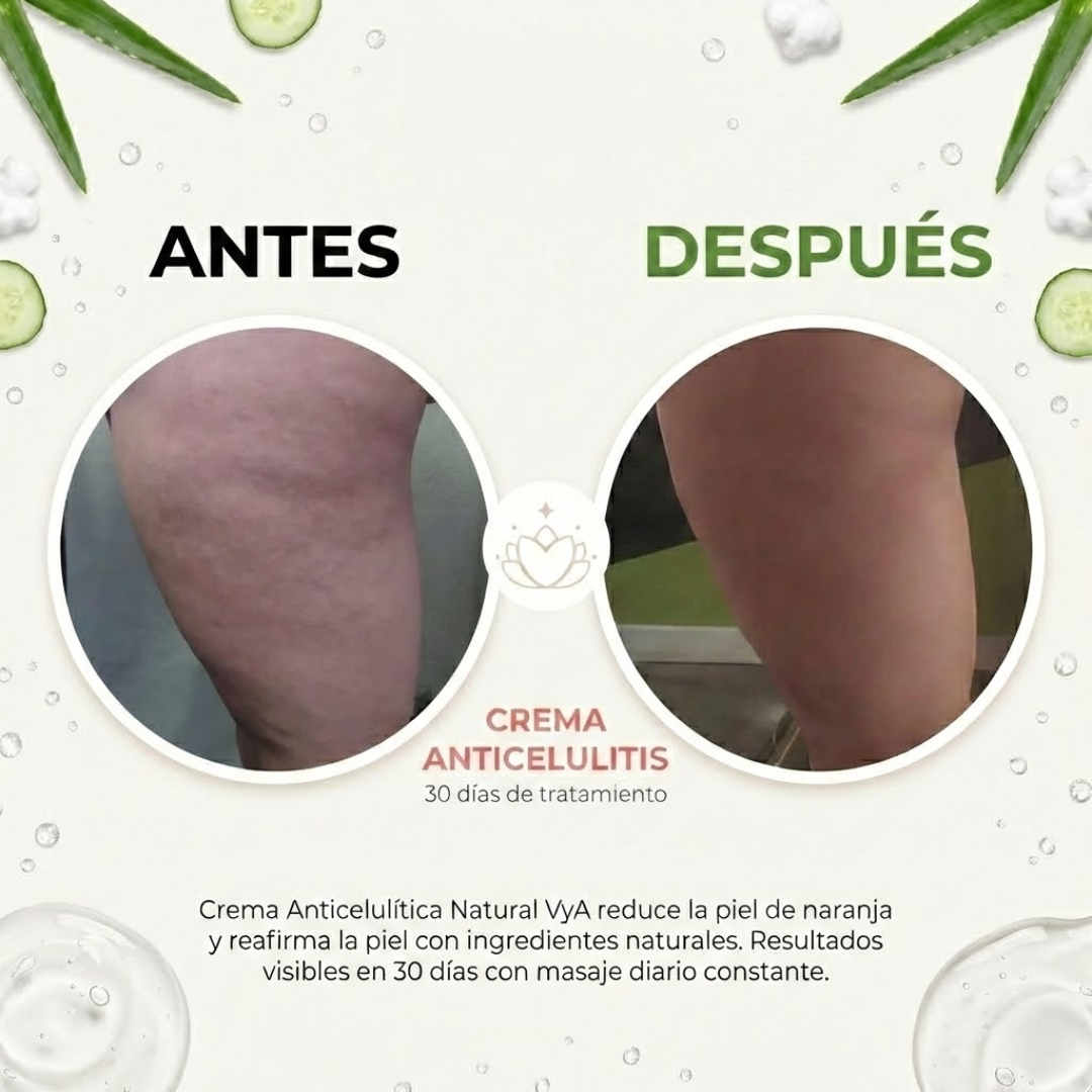KIT CELULITIS VYA