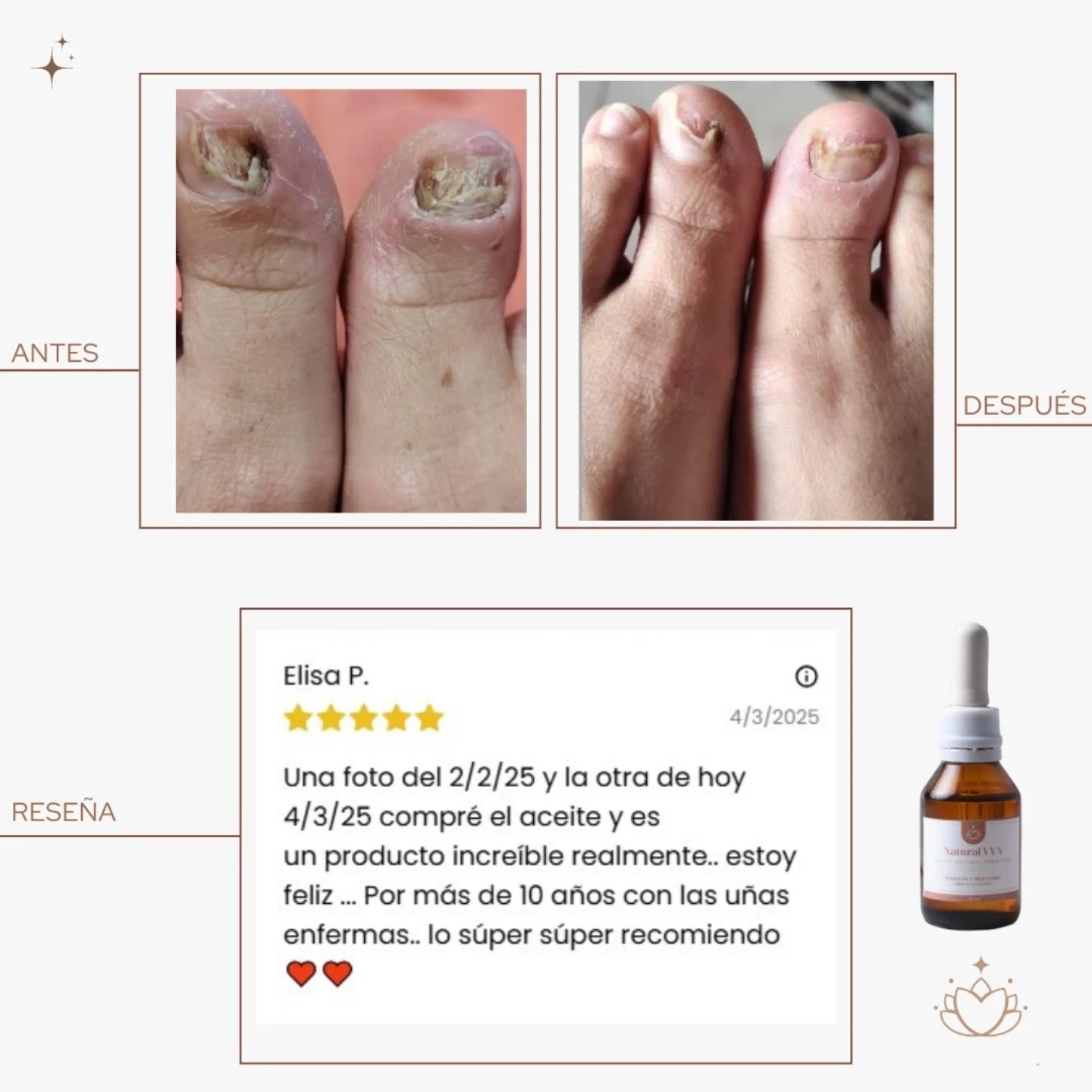 Aceite Antihongos para PIES - 30ml.