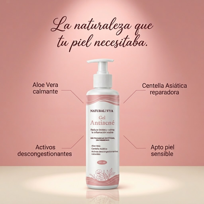 Gel Natural para el Acné
