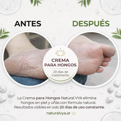 Crema para Hongos con Tea Tree 120ml.