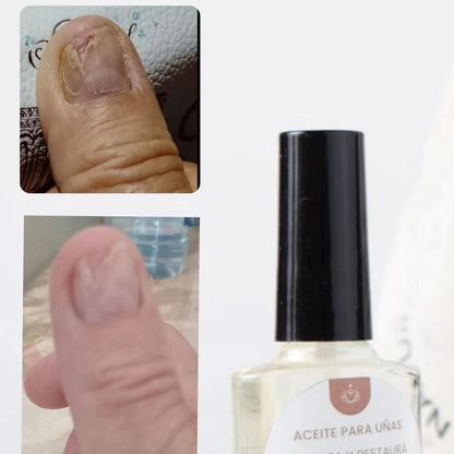 Laca AntiHongos de Manos - 10ml MAYORISTA