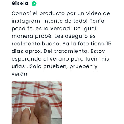 Crema Antihongos con TeaTree 120ml.