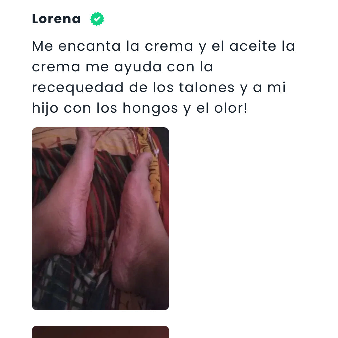 Crema Antihongos con TeaTree 120ml.