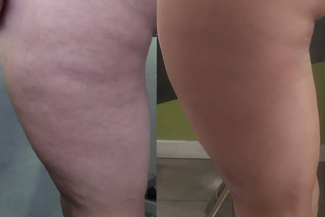 Gel de Ducha Anticelulítico 125ml.