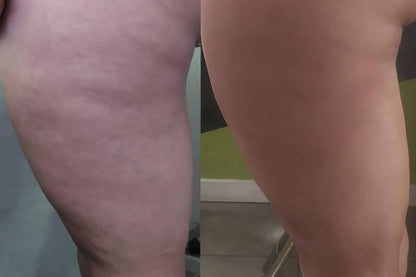 Gel de Ducha Anticelulítico 125ml.