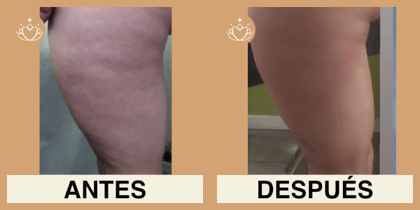 Crema Anticelulitis 125ml.