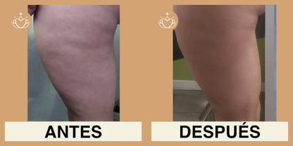 Crema Anticelulitis 125ml.